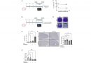 Benidipine calcium channel blocker improves cigarette smoke-induced lung emphysema: Study